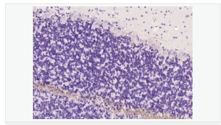 6054102e755cc.png image.png