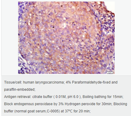 6054470260f1d.png image.png